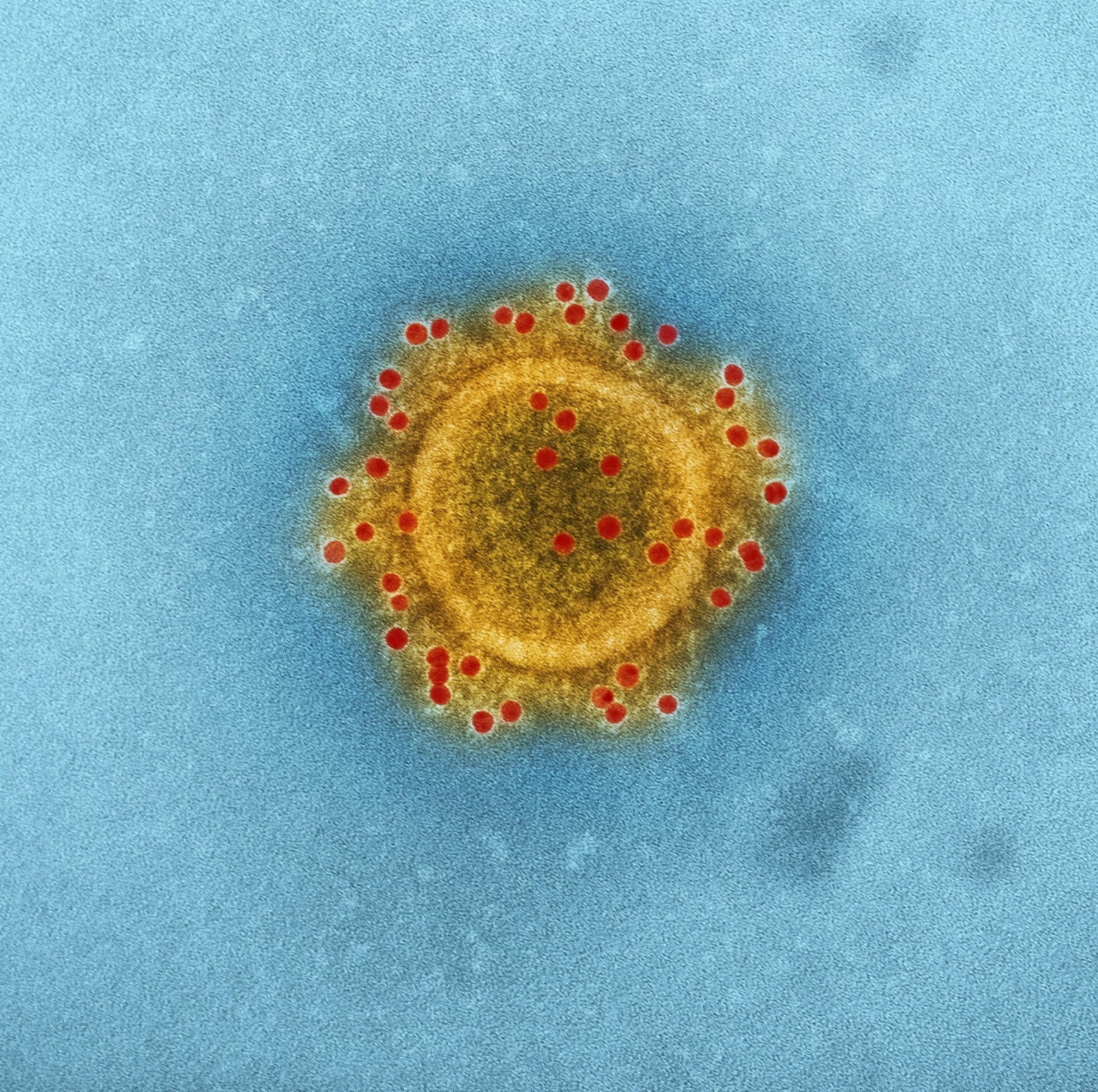 Pathogen detection
